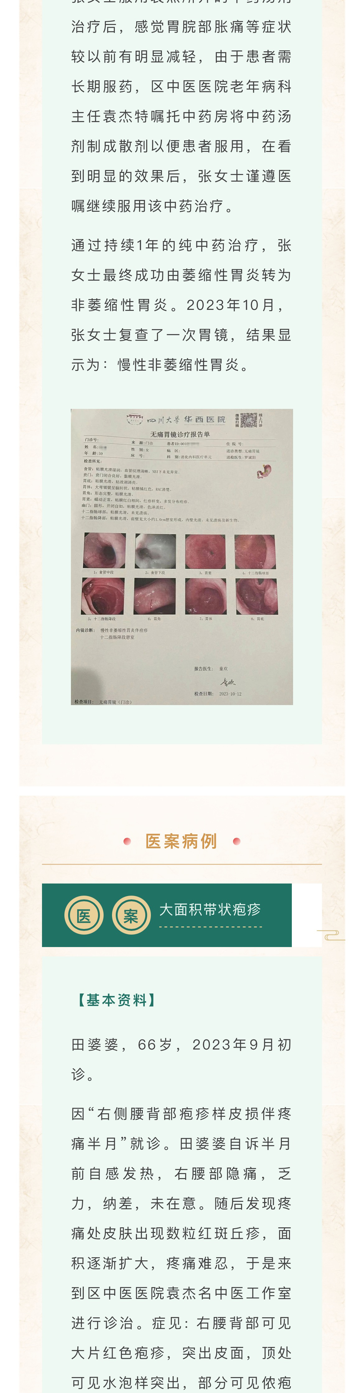 1697592935831092203.jpg 1_04.jpg